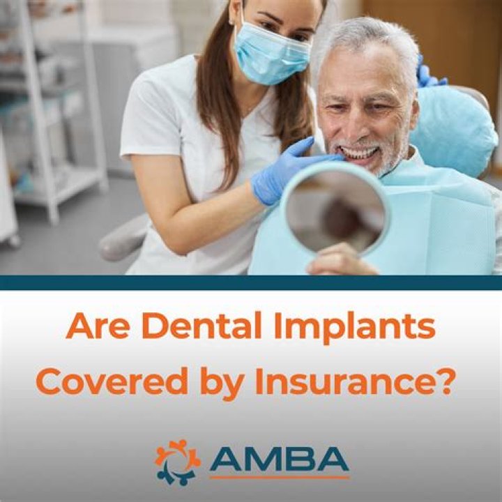 Are dental caps covered by insurance?