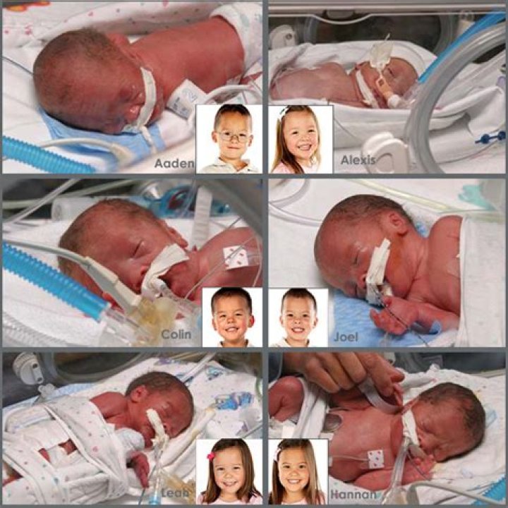 Did Kate Gosselin give birth naturally?