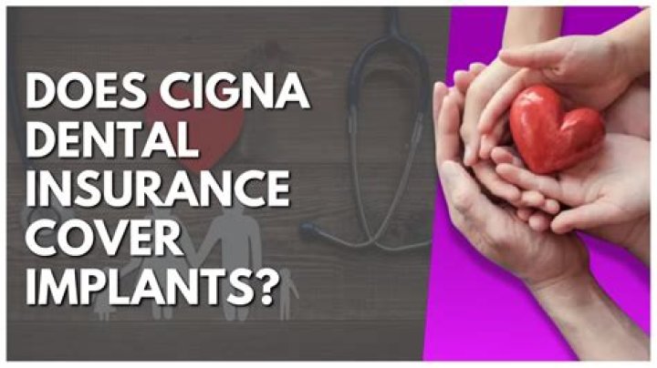 Does Aspen insurance cover dental?