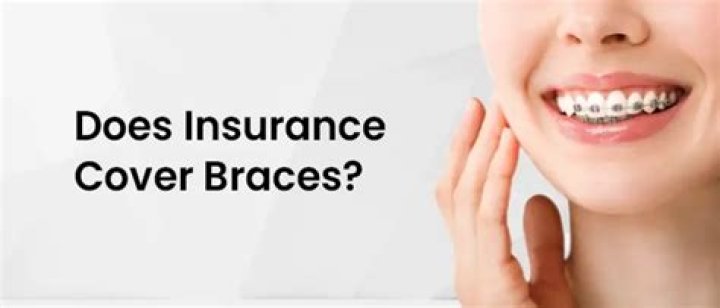 Does insurance cover Invisalign if medically necessary?
