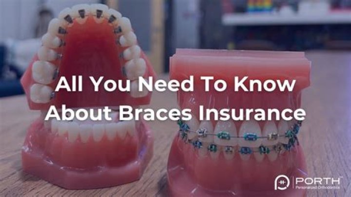 Does Kaiser insurance pay for braces?