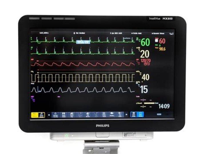 How do I monitor ULIP?