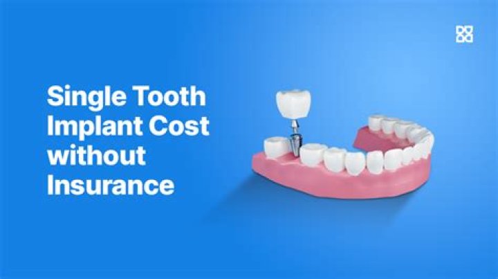How much does a routine dental visit cost without insurance?