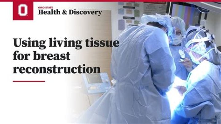 How much is breast reconstruction surgery?