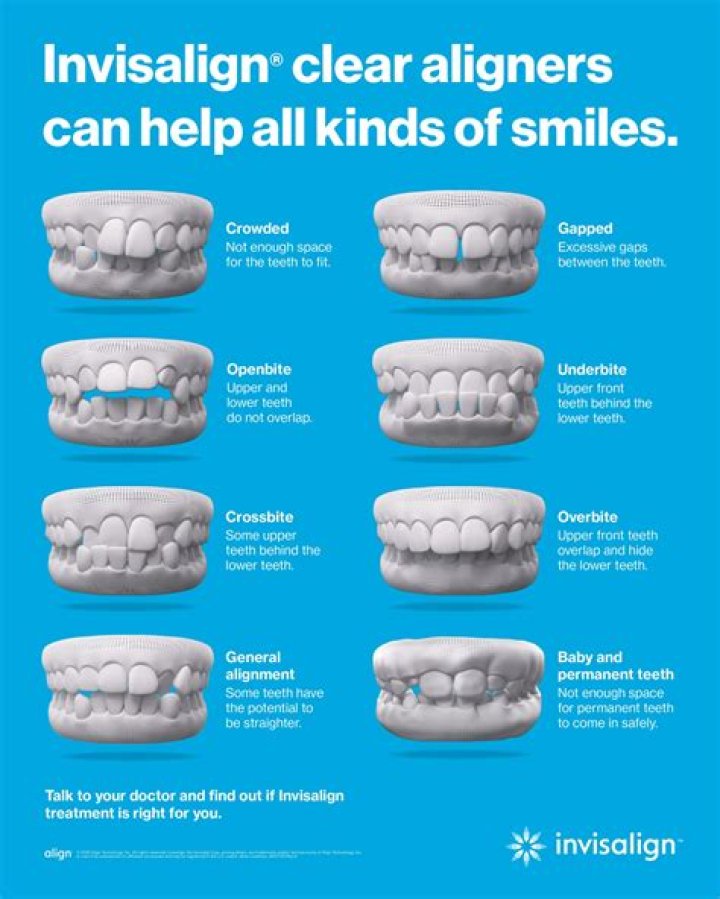How much will Invisalign cost me with insurance?