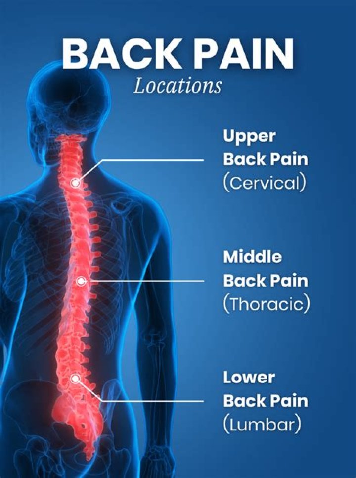 Is back pain considered a medical condition?