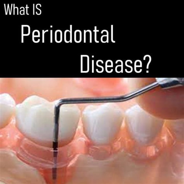 Is periodontal disease covered under insurance?