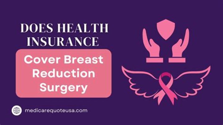 Under what circumstances will insurance cover breast augmentation?