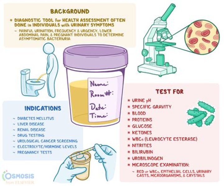 What does a standard urine test check for?