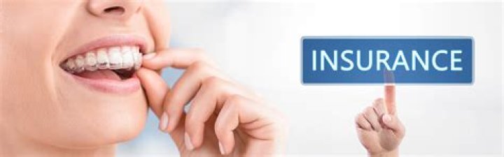 Which dental insurance cover Invisalign?
