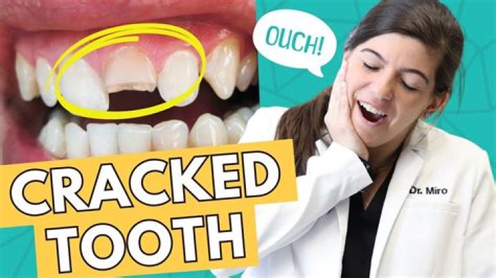 Will a dentist pull a tooth without insurance?