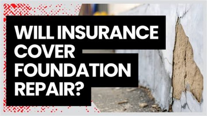 Will insurance cover an implant?